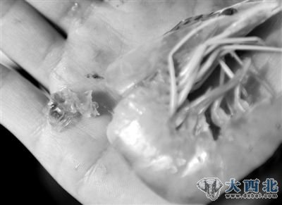 2月13日，记者从购买的“注胶虾”头部挤出胶状透明物质。新华社记者 岳月伟 摄